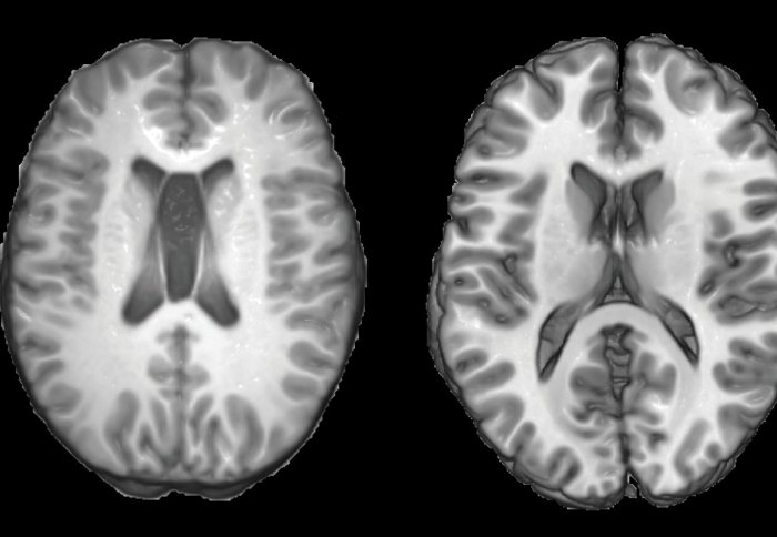 BRAIN SCIENCES_tbi