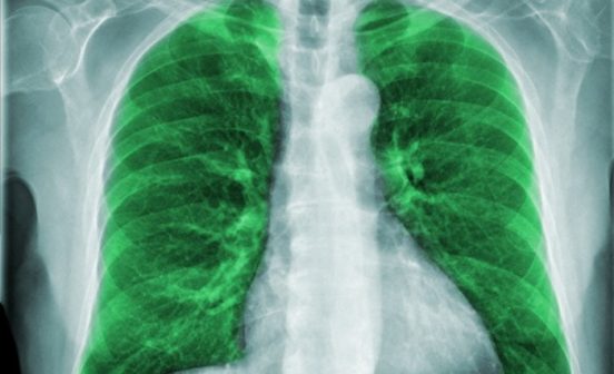 Diagnostic Early childhood Respiratory disease is associated with a higher risk of death in adulthood