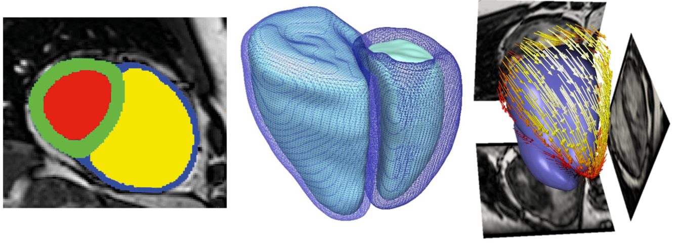 MachineLearning_Tim_3D_Heart.tif