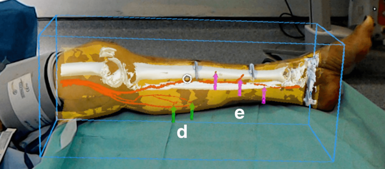 hololens leg_tiny