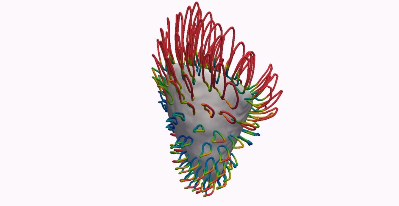 Cardiac Imaging