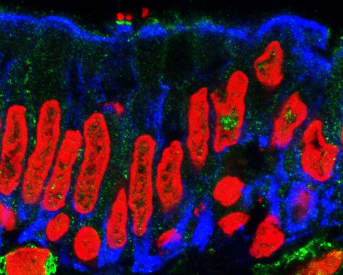 eColi on intestine_small (1)