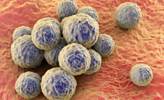 Prevention Imperial researchers reverse antibiotic resistance in MRSA in the lab