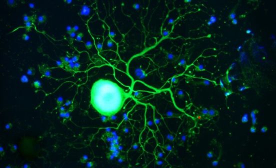 Informatics Approaches Epigenomic “map” helps predict nerve cells’ ability to regenerate after injury