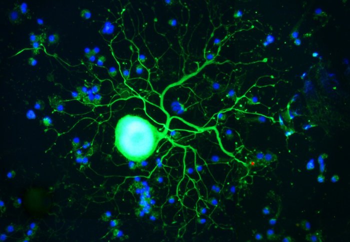 dorsal root ganglion