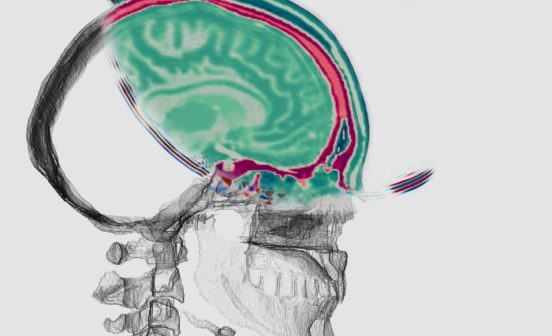 DiagnosticTherapeutic COVID-19 Human Challenge Study highlights minor changes to memory and cognition