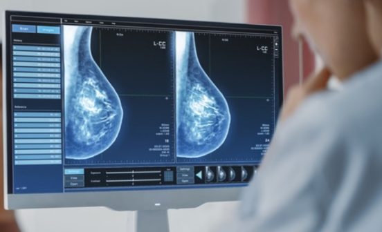InnovationTherapeutic Changing the order of breast cancer treatments may lead to better care