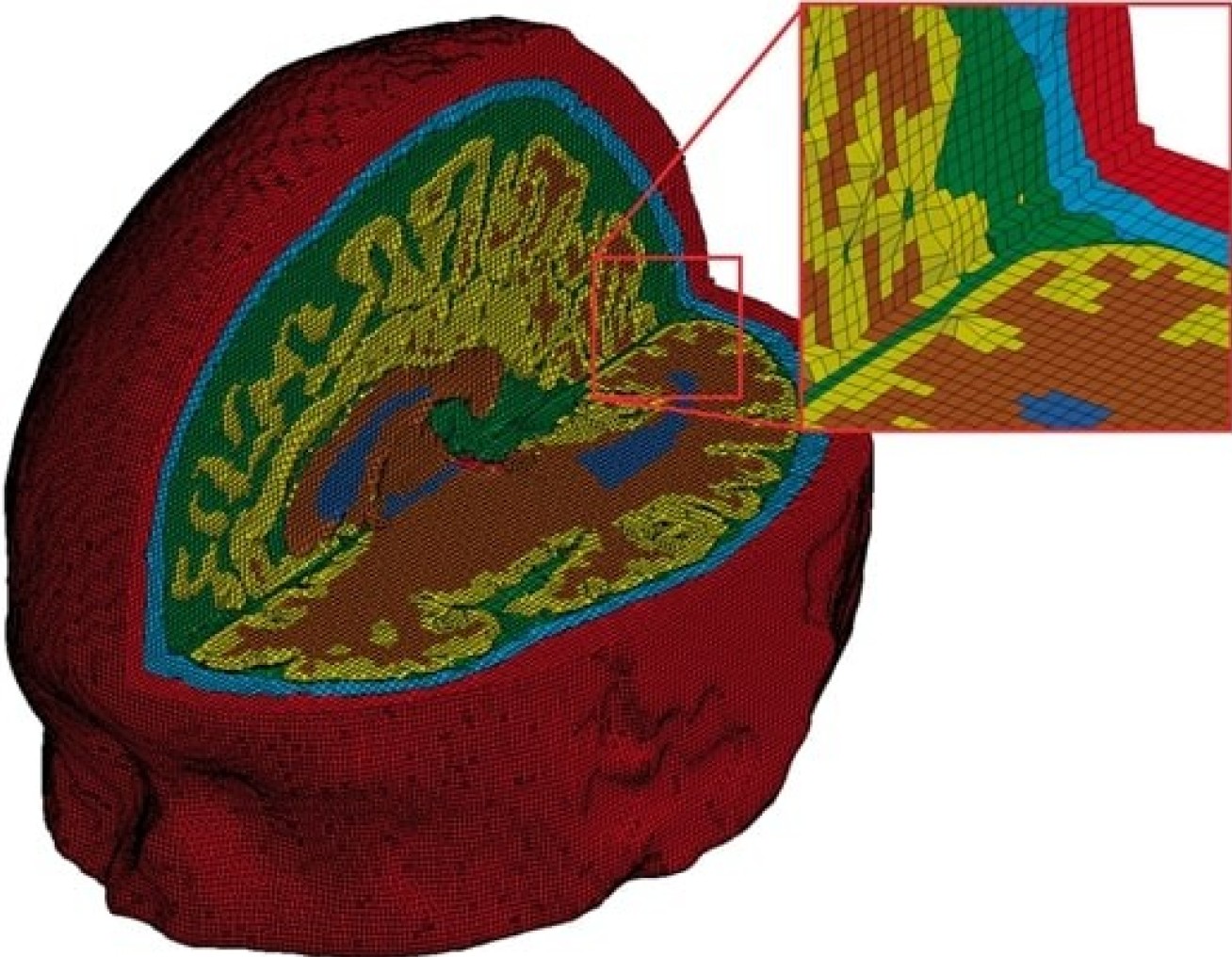 Image of the 3D modelling system used to examine the brain after injury.