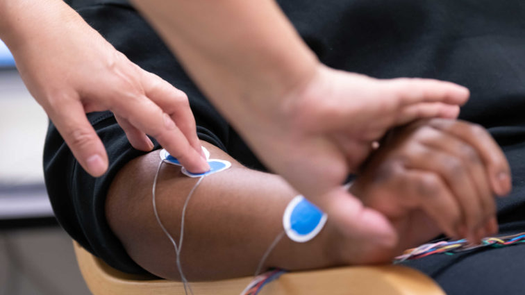 patient with electrodes on forearm