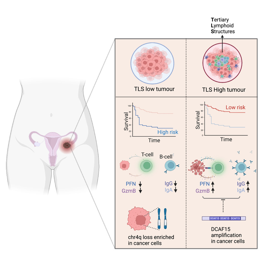 Graphical abstract of Ovarian Cancer diagnosis