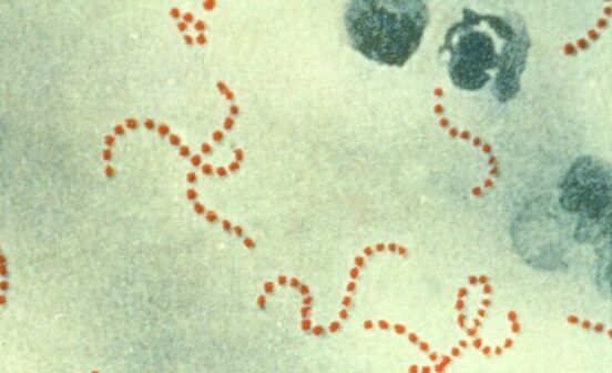 Prevention Analysis uncovers new insights into the global increase in lethal Strep A infections