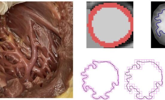 PreventionTherapeutic New insights into heart muscles could provide explanations for heart diseases